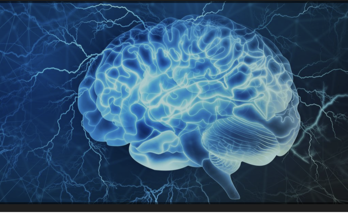 Specialist speech and language therapy stroke brain injury Guernsey